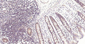 IRF3 Recombinant Rabbit Monoclonal Antibody