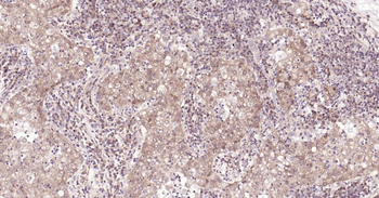 IRF3 Recombinant Rabbit Monoclonal Antibody