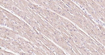 IRF3 Recombinant Rabbit Monoclonal Antibody
