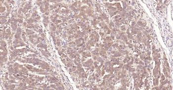 IRF3 Recombinant Rabbit Monoclonal Antibody