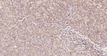 IRF3 Recombinant Rabbit Monoclonal Antibody
