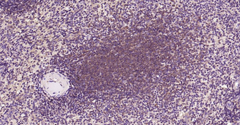 IRF3 Recombinant Rabbit Monoclonal Antibody