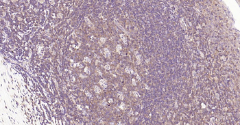 IRF3 Recombinant Rabbit Monoclonal Antibody