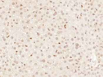Smad3 Recombinant Rabbit Monoclonal Antibody