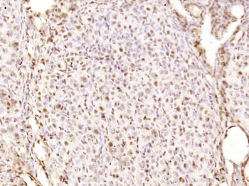 Smad3 Recombinant Rabbit Monoclonal Antibody