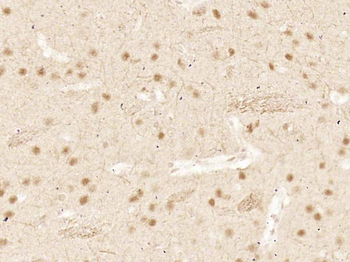 Smad3 Recombinant Rabbit Monoclonal Antibody