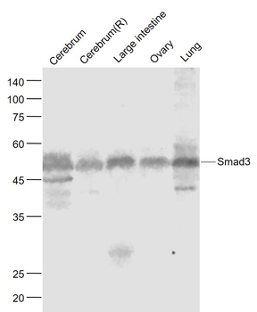Smad3 Recombinant Rabbit Monoclonal Antibody