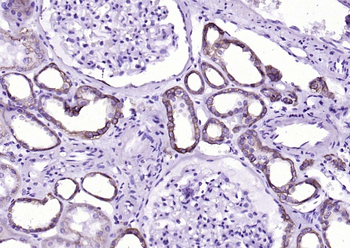 CK18 Recombinant Rabbit Monoclonal Antibody