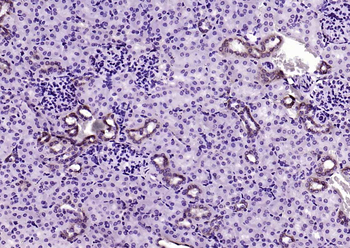 CK18 Recombinant Rabbit Monoclonal Antibody