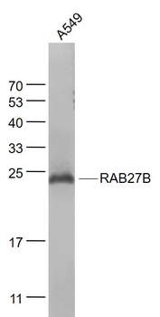 RAB27B Mouse Monoclonal Antibody
