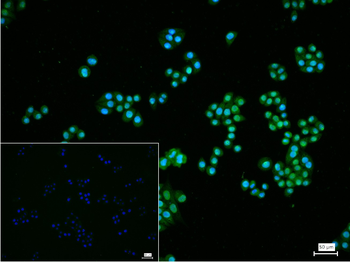 PTEN Mouse Monoclonal Antibody