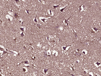 PTEN Mouse Monoclonal Antibody