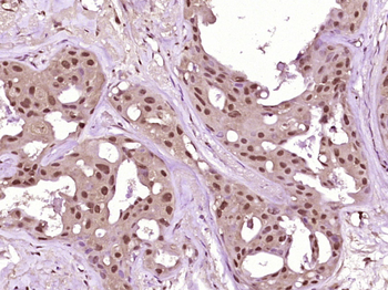 PTEN Mouse Monoclonal Antibody