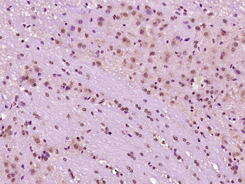 PTEN Mouse Monoclonal Antibody