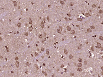 PTEN Mouse Monoclonal Antibody