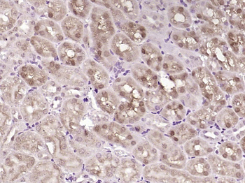 PTEN Mouse Monoclonal Antibody