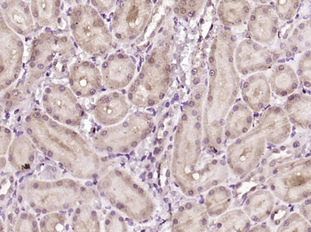 PTEN Mouse Monoclonal Antibody