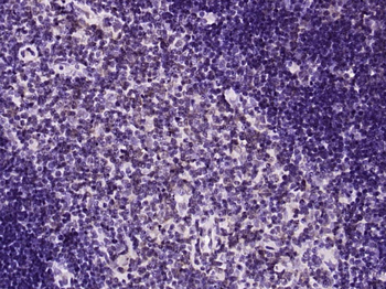 PTEN Mouse Monoclonal Antibody