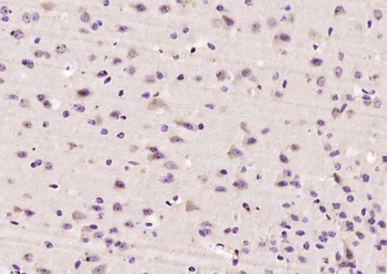 SMAD7 Rabbit Polyclonal Antibody