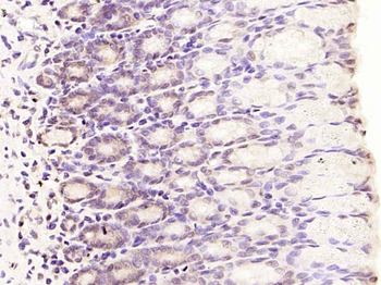 SMAD7 Rabbit Polyclonal Antibody