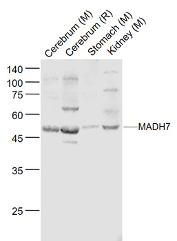 SMAD7 Rabbit Polyclonal Antibody