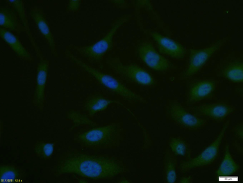 SMAD7 Rabbit Polyclonal Antibody