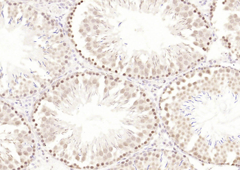 HP1 gamma Mouse Monoclonal Antibody