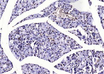 Histone H3 (di methyl K36) Mouse Monoclonal Antibody