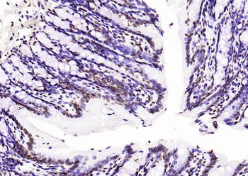 Histone H3 (di methyl K36) Mouse Monoclonal Antibody
