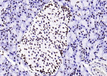 Histone H3 (di methyl K36) Mouse Monoclonal Antibody