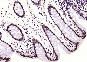 Histone H3 (di methyl K36) Mouse Monoclonal Antibody