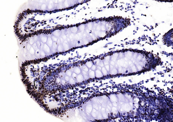 Histone H3 (di methyl K36) Mouse Monoclonal Antibody