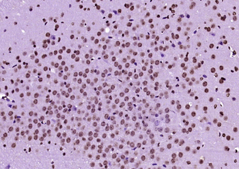 Histone H3 (di methyl K36) Mouse Monoclonal Antibody