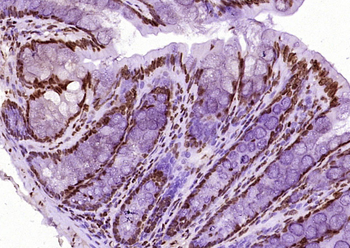 Histone H3 (di methyl K36) Mouse Monoclonal Antibody