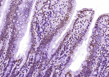 Histone H3 (di methyl K36) Mouse Monoclonal Antibody