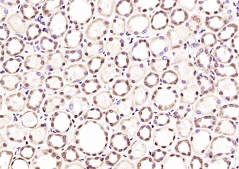 Histone H3 (tri methyl K36) Mouse Monoclonal Antibody