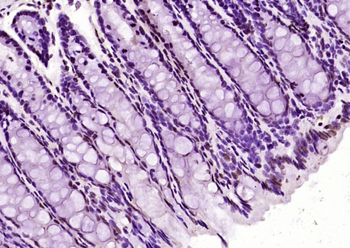 Histone H3 (tri methyl K36) Mouse Monoclonal Antibody