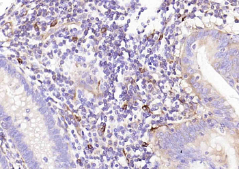 CD74 Mouse Monoclonal Antibody