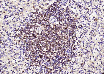 CD74 Mouse Monoclonal Antibody