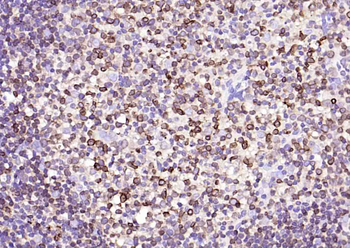 CD74 Mouse Monoclonal Antibody