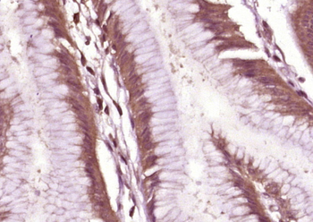 EGFR Mouse Monoclonal Antibody