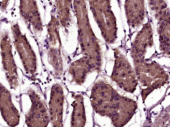 EGFR Mouse Monoclonal Antibody