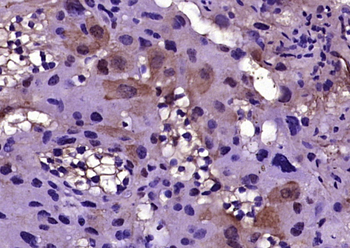 NAP2 Rabbit Polyclonal Antibody
