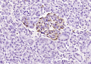 Phospholipase D2 Rabbit Polyclonal Antibody