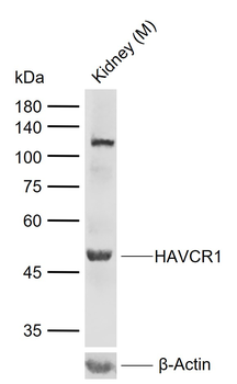 HAVCR1 Rabbit Polyclonal Antibody