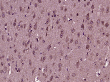 TBC1D4 Rabbit Polyclonal Antibody