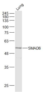SMAD6 Rabbit Polyclonal Antibody