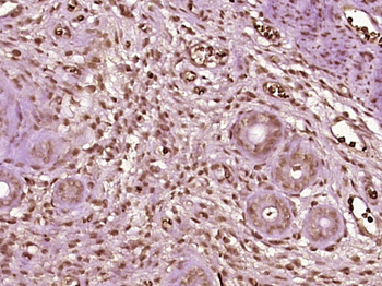 SMAD6 Rabbit Polyclonal Antibody