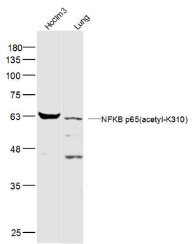 NFKB p65 (acetyl K310) Rabbit Polyclonal Antibody