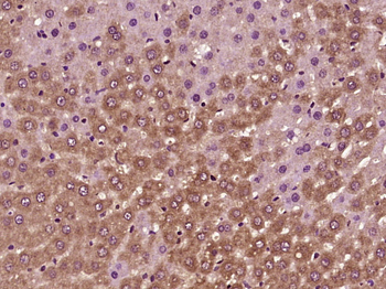 GCLM Rabbit Polyclonal Antibody